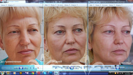 LUMINESCE™ БЕЗУПРЕЧНАЯ КОЖА BRIGHTENER