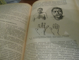 1972 * Внутренние болезни * 416 страниц *Учебник * 8
