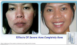 ЕЖЕДНЕВНЫЙ УВЛАЖНЯЮЩИЙ КОМПЛЕКС LUMINESCE 4,573.00