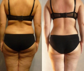 Коррекция фигуры 3