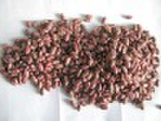 Light Speckled Kidney Bean