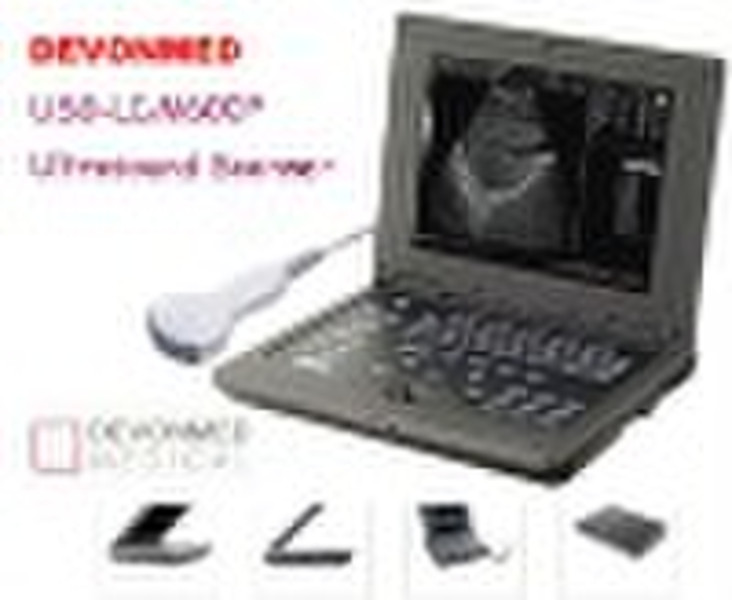 Portable Ultrasound Scanner----CE Approved