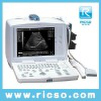Ultrasound Scanner--portable ultrasound scanner