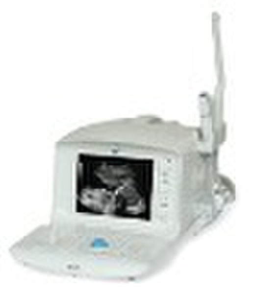 Full digital portable ultrasound scanner