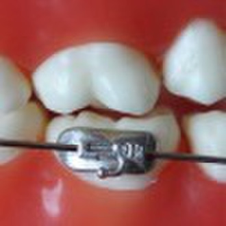 Orthodontic tubes-Buccal tubes