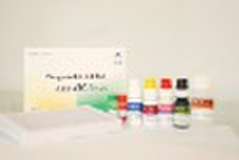 Anti-HCV-ELISA-Test-Kit