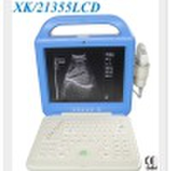 Laptop Ultrasound Scanner(CE Approved)