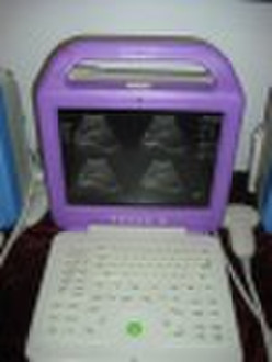 Digital Laptop Ultrasound Scanner (CE  )for East T