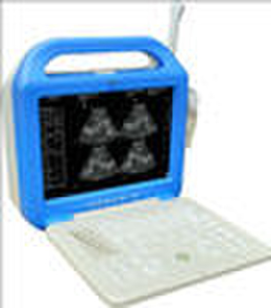 Laptop Ultrasound Scanner(CE Approved)