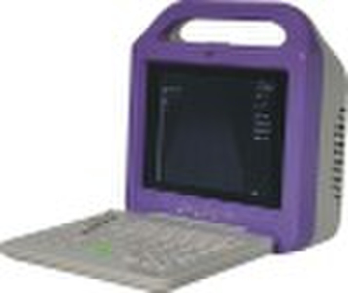 Annalogue Ultrasound Machine(CE Approved)