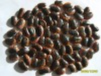 sell light speckled kindney bean