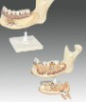 Human denture model