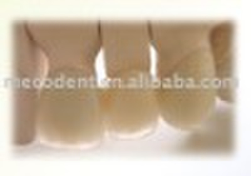 Dental Zirconium bridge