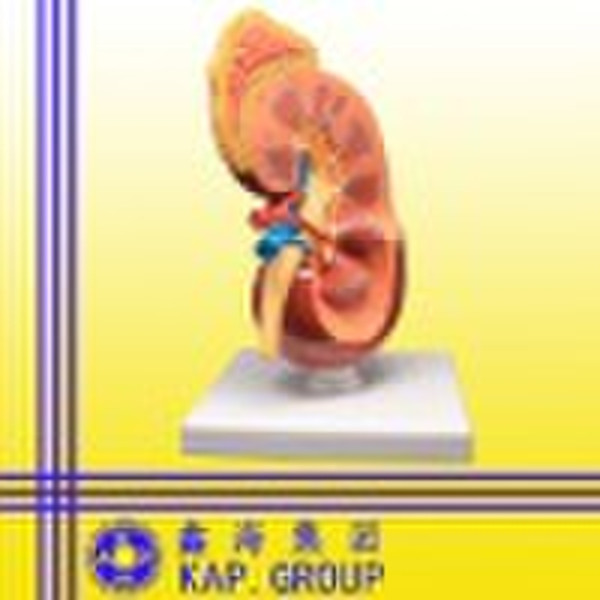 kidney anatomical model