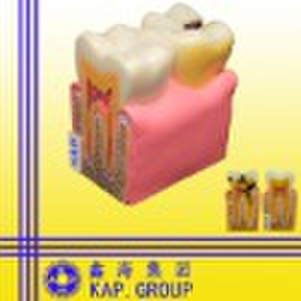 anatomy model/teeth model