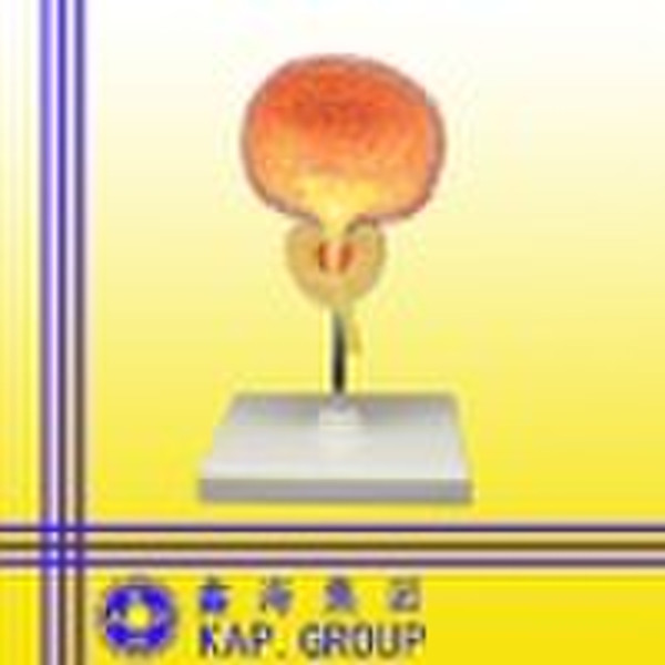 bladder prostate model,anatomical model,medical mo