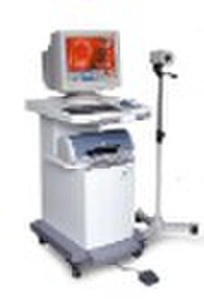 colposcope