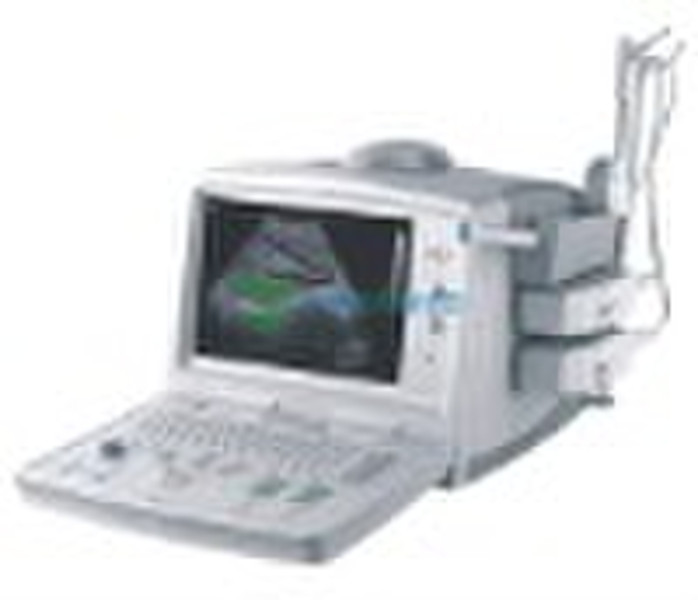 Digital ultrasound diagnostic system