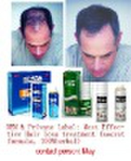 HOT Herbal YuDa Spray the fastest hair growth