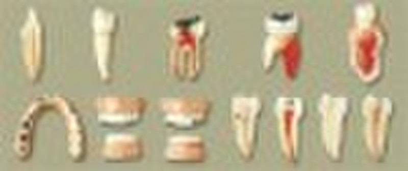 Dental Diseases Model(antomical model)