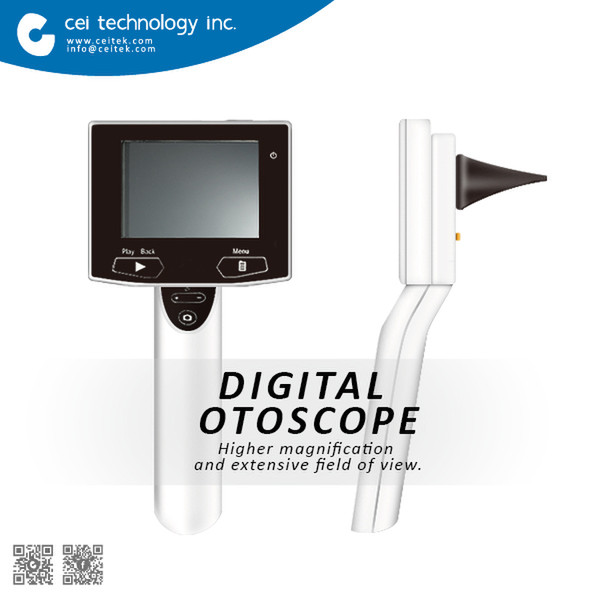Digital Video Otoscope