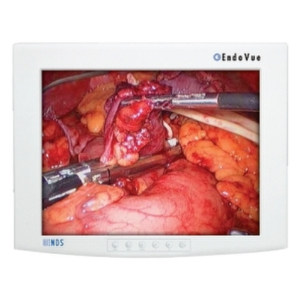 NDS Surgical Imaging EndoVue 15'' 15Zoll IPS Weiß Computerbildschirm